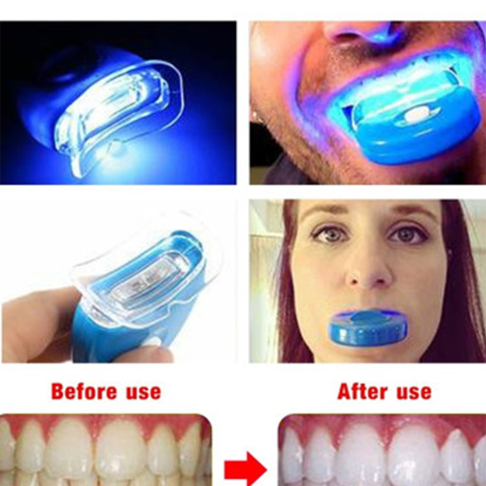 LED Teeth Whitening Light Whit - Teeth Whitening Laser Treatment review and price