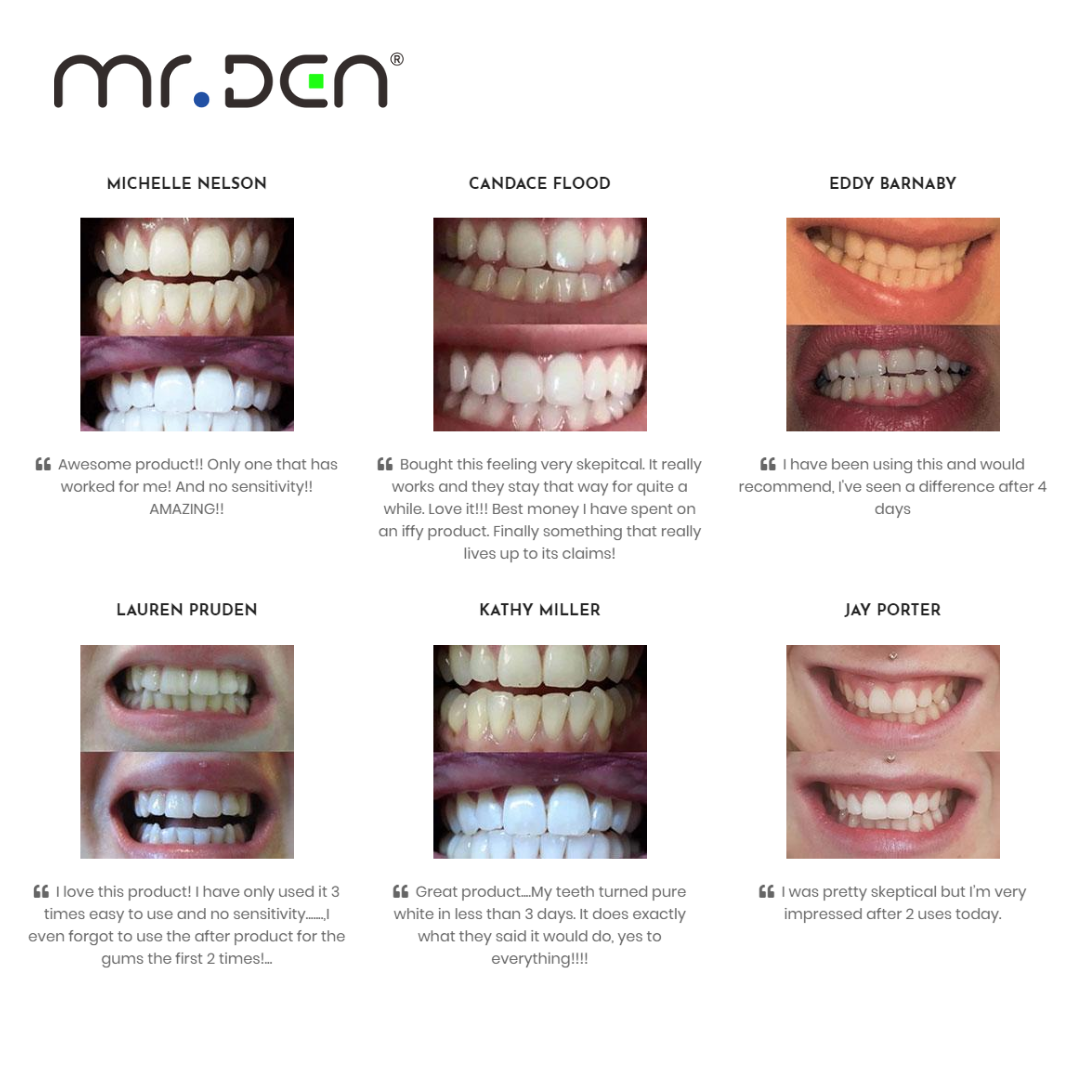 Dr. Whiten 3 Pack Teeth Whiten - Whitening Teeth Machine review and price