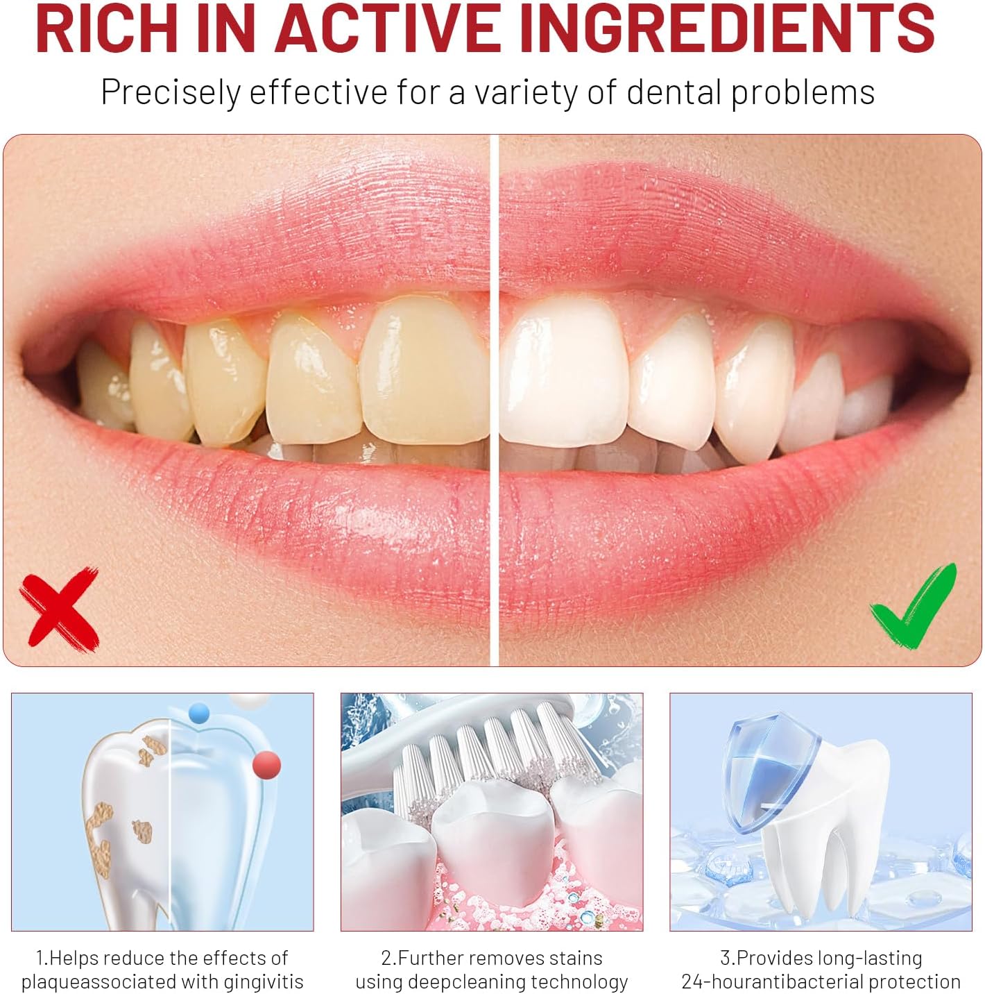 Niacinamide Whitening Toothpas - Teeth Whitening Treatment review and price