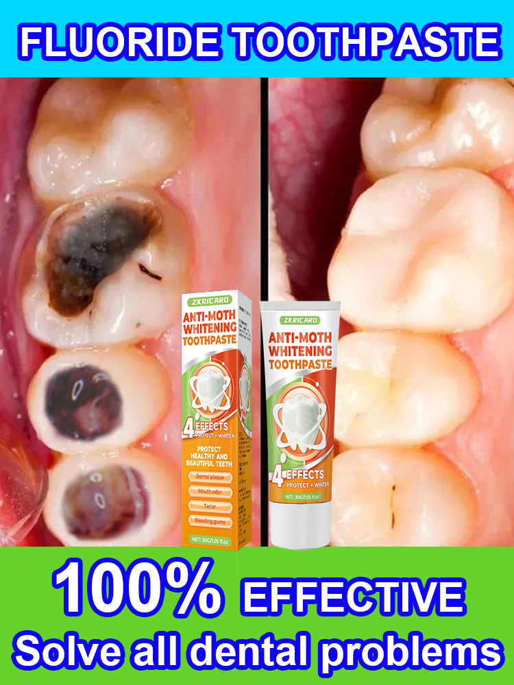 Repair tooth decay and whiten  - Teeth Whitening Treatment review and price