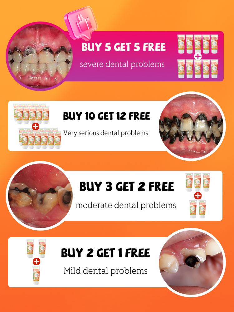 Repair tooth decay and whiten  - Teeth Whitening Treatment review and price