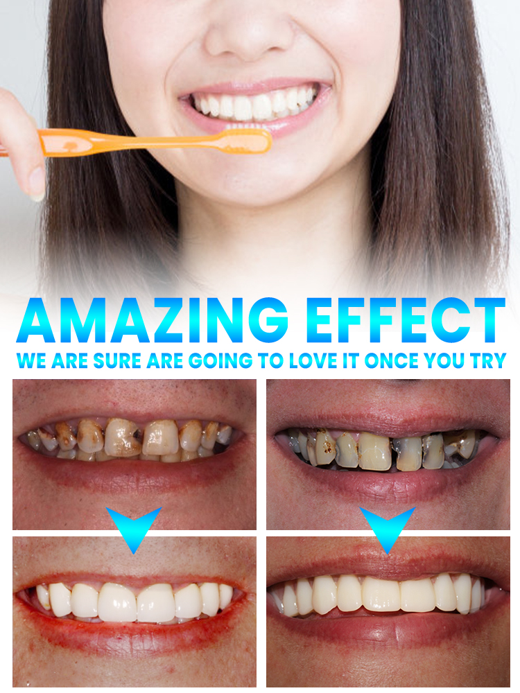 Repair tooth decay and whiten  - Teeth Whitening Treatment review and price