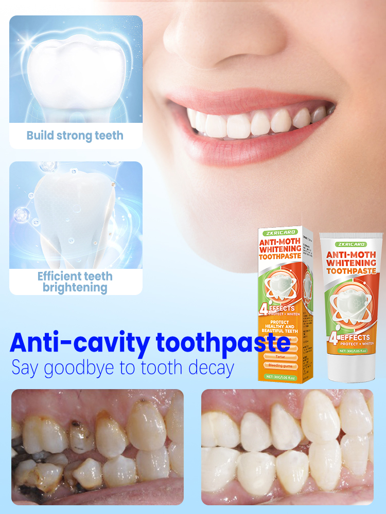 Repair tooth decay and whiten  - Teeth Whitening Treatment review and price