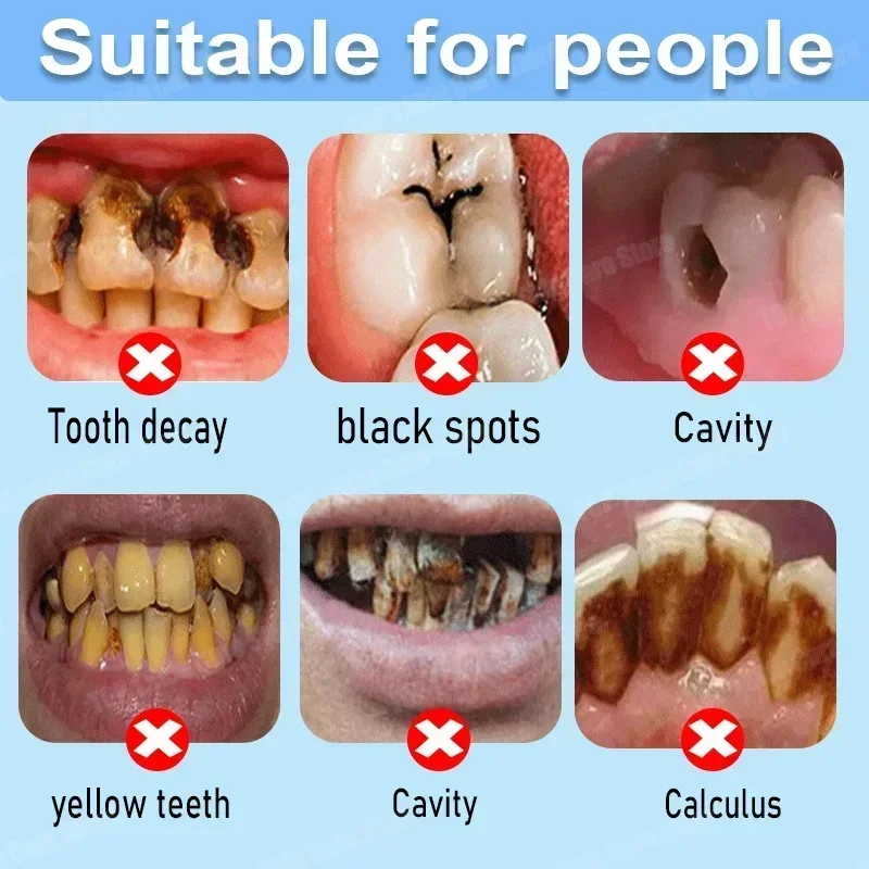 Anti Decay Toothpaste repairs  - Teeth Whitening Treatment review and price