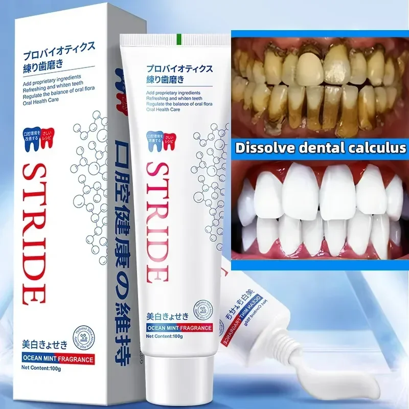 Dental Calculus Remover Remova - Teeth Whitening Treatment review and price