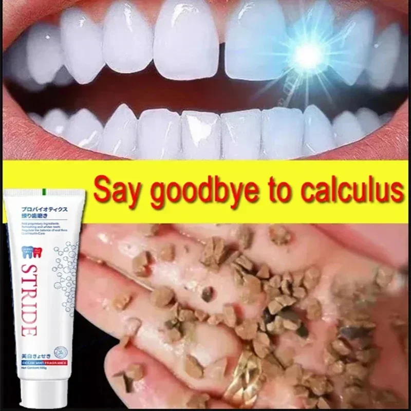 Dental Calculus Remover Remova - Teeth Whitening Treatment review and price