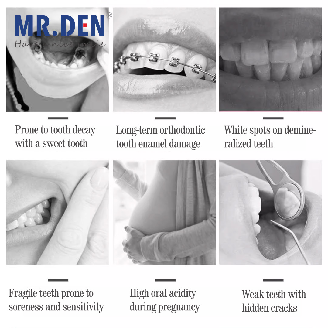 Japan GC Fluoride Enhanced Den - Teeth Whitening In Japan review and price