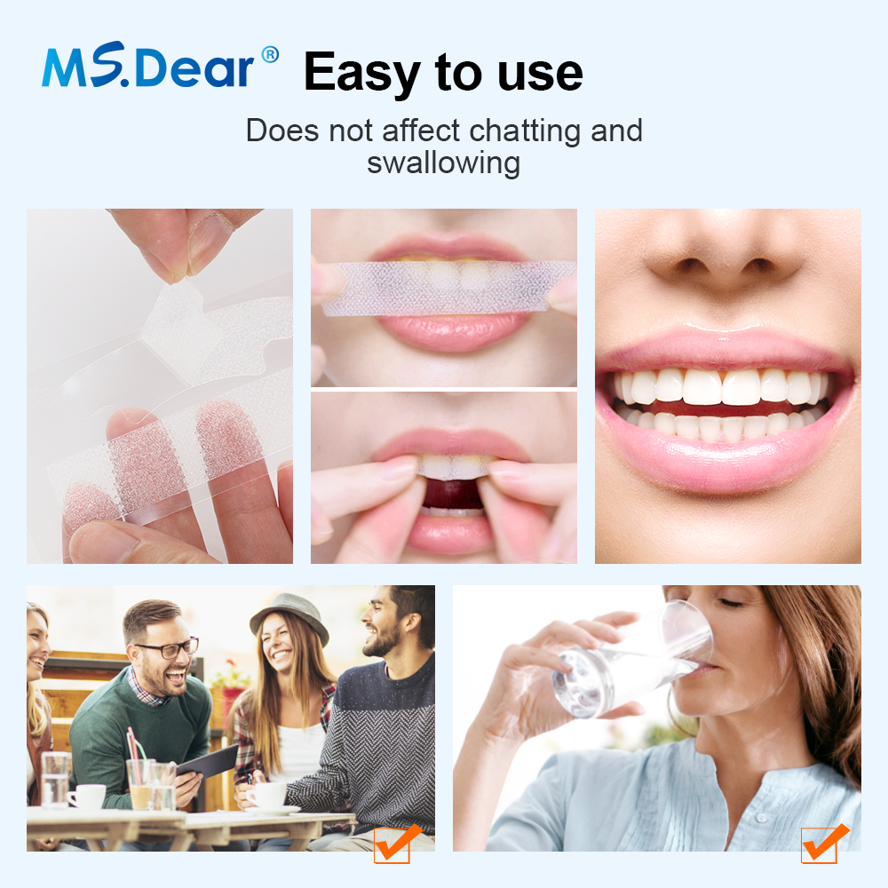 7/14/21/28/70 Pairs 9D Gel Tee - Teeth Whitening Doctor review and price