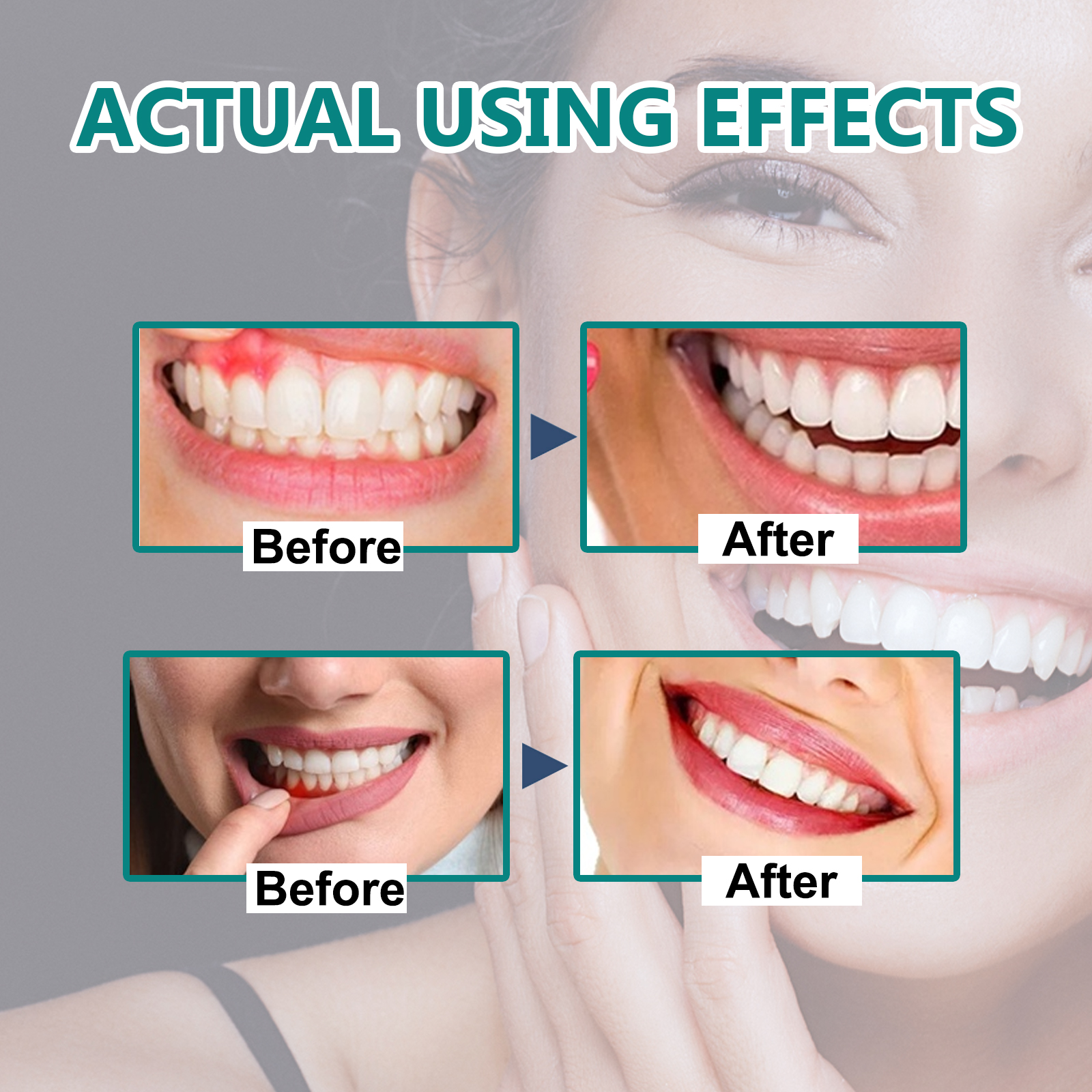 Gingival repair drops Quickly  - Teeth Whitening Oil Pulling review and price